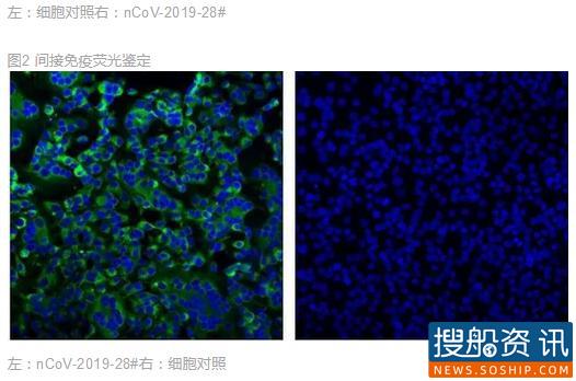 疫情期间 船舶垃圾处理问题必须重视 疫情期间 船舶垃圾处理问题必须重视